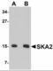 Spindle And Kinetochore Associated Complex Subunit 2 antibody, orb94327, Biorbyt, Western Blot image 