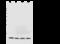 B2M antibody, 11976-MM35, Sino Biological, Western Blot image 