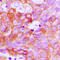 Ephrin A1 antibody, GTX56156, GeneTex, Immunohistochemistry paraffin image 