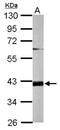 Terminal Nucleotidyltransferase 5D antibody, NBP2-16417, Novus Biologicals, Western Blot image 