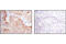 EGFR antibody, 3777P, Cell Signaling Technology, Immunohistochemistry paraffin image 