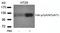 Protein Tyrosine Kinase 2 antibody, orb15015, Biorbyt, Western Blot image 