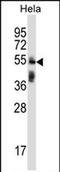 Tripartite Motif Containing 38 antibody, PA5-71809, Invitrogen Antibodies, Western Blot image 
