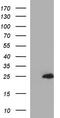 Glycolipid Transfer Protein antibody, M06187, Boster Biological Technology, Western Blot image 