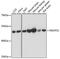 NADH dehydrogenase [ubiquinone] iron-sulfur protein 2, mitochondrial antibody, GTX35213, GeneTex, Western Blot image 