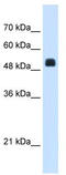 N-Acetylglutamate Synthase antibody, TA339882, Origene, Western Blot image 