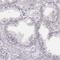 Homeobox protein MSX-1 antibody, HPA073604, Atlas Antibodies, Immunohistochemistry frozen image 