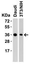 R-spondin-1 antibody, A02857-1, Boster Biological Technology, Western Blot image 