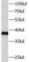 Deltex E3 Ubiquitin Ligase 3 antibody, FNab02555, FineTest, Western Blot image 