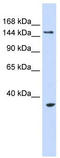 Ubiquitin Protein Ligase E3B antibody, TA330496, Origene, Western Blot image 