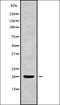 Protein Phosphatase 3 Regulatory Subunit B, Beta antibody, orb338089, Biorbyt, Western Blot image 