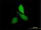 CNKSR Family Member 3 antibody, H00154043-B01P, Novus Biologicals, Immunofluorescence image 