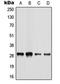 Basic Leucine Zipper ATF-Like Transcription Factor 2 antibody, orb215351, Biorbyt, Western Blot image 