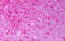 Prolyl 4-Hydroxylase Subunit Beta antibody, MBS247147, MyBioSource, Immunohistochemistry paraffin image 