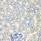 N(Alpha)-Acetyltransferase 50, NatE Catalytic Subunit antibody, LS-C746839, Lifespan Biosciences, Immunohistochemistry frozen image 