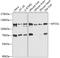 Metastasis suppressor protein 1 antibody, GTX64997, GeneTex, Western Blot image 