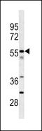 Carboxypeptidase N subunit 2 antibody, LS-C100528, Lifespan Biosciences, Western Blot image 