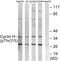Cyclin-H antibody, LS-C198867, Lifespan Biosciences, Western Blot image 