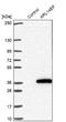 ADP Ribosylation Factor Like GTPase 14 Effector Protein antibody, NBP2-48890, Novus Biologicals, Western Blot image 