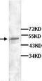 Decapping MRNA 2 antibody, TA310110, Origene, Western Blot image 