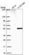 Phosphatidylinositol-5-phosphate 4-kinase type-2 beta antibody, NBP2-56946, Novus Biologicals, Western Blot image 