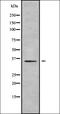 5-Hydroxytryptamine Receptor 3B antibody, orb336380, Biorbyt, Western Blot image 
