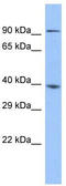Zinc Finger And SCAN Domain Containing 5A antibody, TA339859, Origene, Western Blot image 