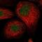 Vesicle Associated Membrane Protein 5 antibody, NBP1-85913, Novus Biologicals, Immunocytochemistry image 