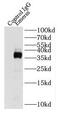 STA antibody, FNab02753, FineTest, Immunoprecipitation image 