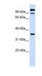 Protein Tyrosine Phosphatase Receptor Type E antibody, NBP1-62460, Novus Biologicals, Western Blot image 