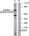 Serine/Threonine Kinase 11 antibody, A00217S428, Boster Biological Technology, Western Blot image 