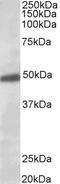 Potassium Voltage-Gated Channel Subfamily J Member 6 antibody, TA303283, Origene, Western Blot image 