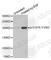 EGFR antibody, AP0154, ABclonal Technology, Western Blot image 