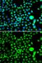 Structural Maintenance Of Chromosomes Flexible Hinge Domain Containing 1 antibody, GTX32883, GeneTex, Immunocytochemistry image 