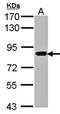 VPS16 Core Subunit Of CORVET And HOPS Complexes antibody, orb69691, Biorbyt, Western Blot image 