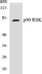 Ribosomal Protein S6 Kinase A1 antibody, EKC1434, Boster Biological Technology, Western Blot image 
