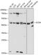 Glutaryl-CoA Dehydrogenase antibody, 23-782, ProSci, Western Blot image 