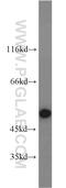 RNA Binding Motif Protein 22 antibody, 22103-1-AP, Proteintech Group, Western Blot image 