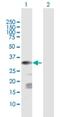 Chondroitin Sulfate N-Acetylgalactosaminyltransferase 1 antibody, H00055790-D01P, Novus Biologicals, Western Blot image 