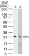 Baculoviral IAP repeat-containing protein 7 antibody, NB100-56548, Novus Biologicals, Western Blot image 