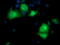 Pyrroline-5-Carboxylate Reductase 3 antibody, M32428-1, Boster Biological Technology, Immunofluorescence image 