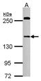 DAZ Interacting Zinc Finger Protein 3 antibody, NBP2-16250, Novus Biologicals, Western Blot image 