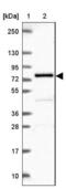 Polypeptide N-Acetylgalactosaminyltransferase 7 antibody, NBP2-39021, Novus Biologicals, Western Blot image 