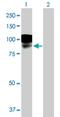 Leucine Rich Repeat And Fibronectin Type III Domain Containing 1 antibody, H00057622-B01P, Novus Biologicals, Western Blot image 