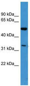Ceramide Kinase Like antibody, TA342755, Origene, Western Blot image 