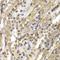 Neural Precursor Cell Expressed, Developmentally Down-Regulated 9 antibody, orb167180, Biorbyt, Immunohistochemistry paraffin image 