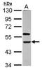 Killer Cell Immunoglobulin Like Receptor, Three Ig Domains And Long Cytoplasmic Tail 1 antibody, GTX113763, GeneTex, Western Blot image 