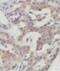 Mitochondrial Ribosomal Protein L14 antibody, FNab05317, FineTest, Immunohistochemistry paraffin image 