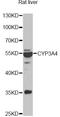 Cytochrome P450 Family 3 Subfamily A Member 4 antibody, LS-C748533, Lifespan Biosciences, Western Blot image 