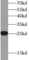 C-Reactive Protein antibody, FNab01995, FineTest, Western Blot image 